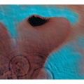 Meddle