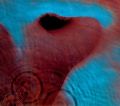 Meddle