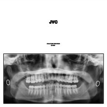 JVC